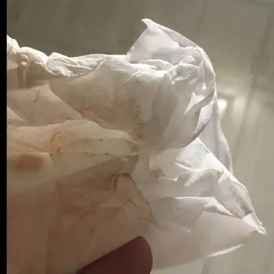 我怀孕五周的时候下面流血,b超说有宫腔积血,在医院住了九天,回来卧床