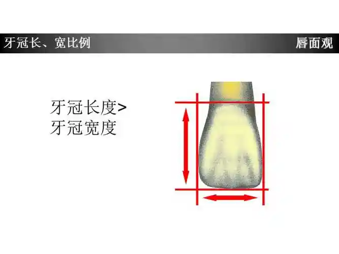 上颌中切牙形态特征简述电子教案.ppt_第5页