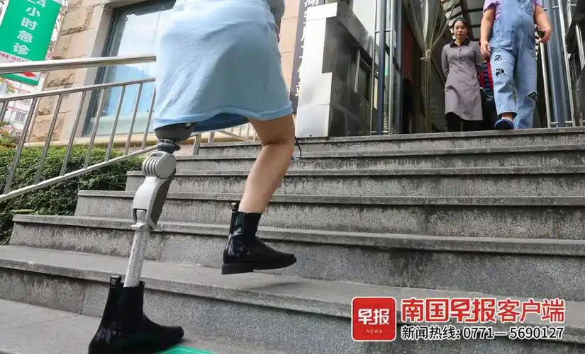"假肢是我的时尚单品!"南宁95后女孩涅槃重生变"右边型战士"