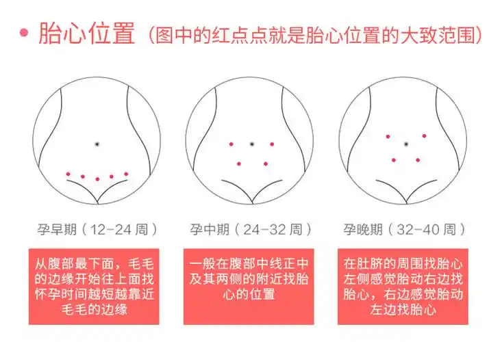 胎心监护监测仪器家用孕妇充电听胎心仪听诊器多普勒测胎动计数器高配