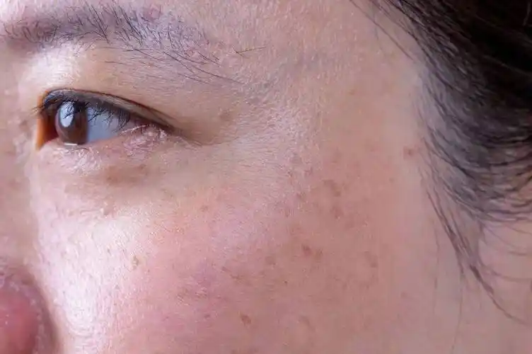 原因终于找到了_皮肤_年龄_皱纹