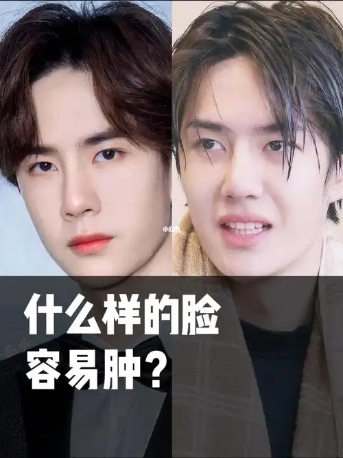 什么样的脸容易肿