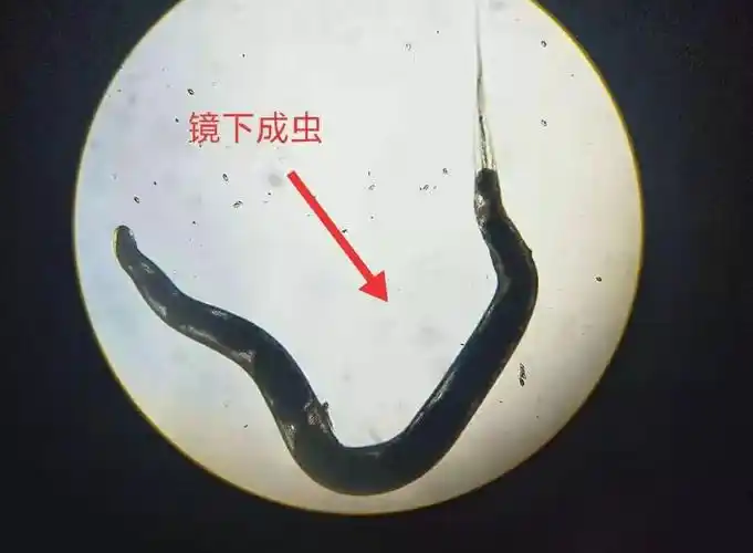 主要寄生于人体回盲部,人群感染率儿童高于成人,以幼儿园和托儿所学龄