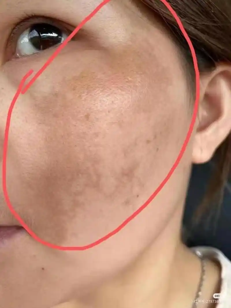 今天给大家介绍一味中药,它对面色暗黄,粗糙,长斑点都有不错的效果.