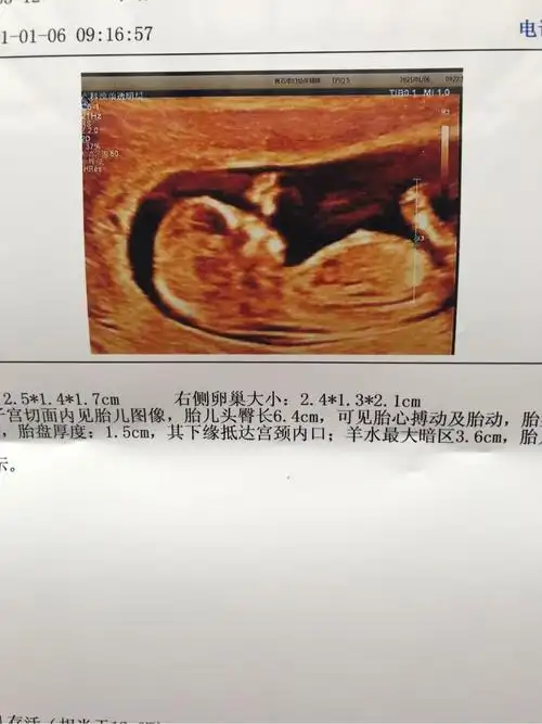 nt怎么看男女,求指教!