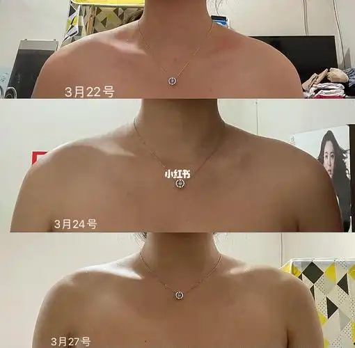 感觉背厚了怎么回事_美丽芭蕾_欧阳春晓_斜方肌_运动健身_健身_徒手