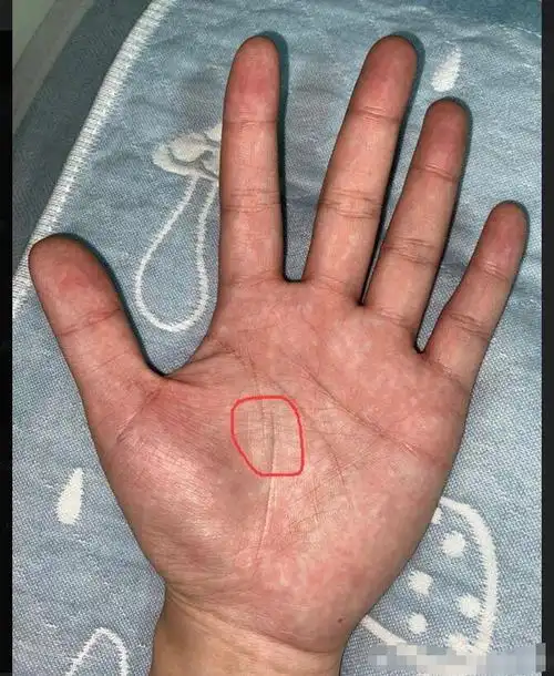 生命线断开分叉又接上_手相生命线分叉断开_断生命线分叉是什么意思