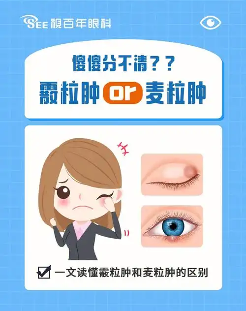 敲黑板60霰粒肿和麦粒肿的区别一定要分清