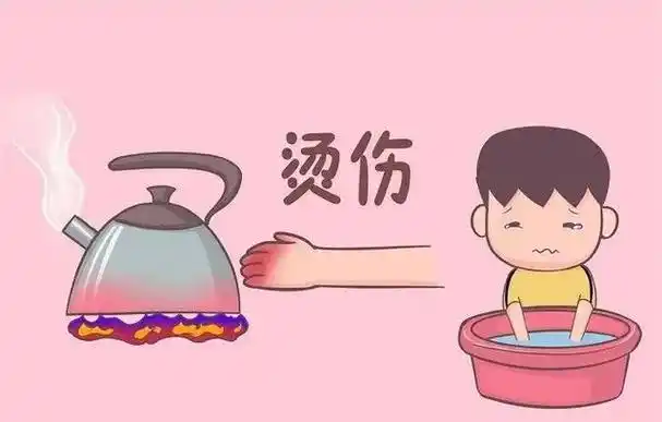 烧伤烫伤最有效的应急办法是什么(还分不清烫伤和烧伤吗)-爱玩科技