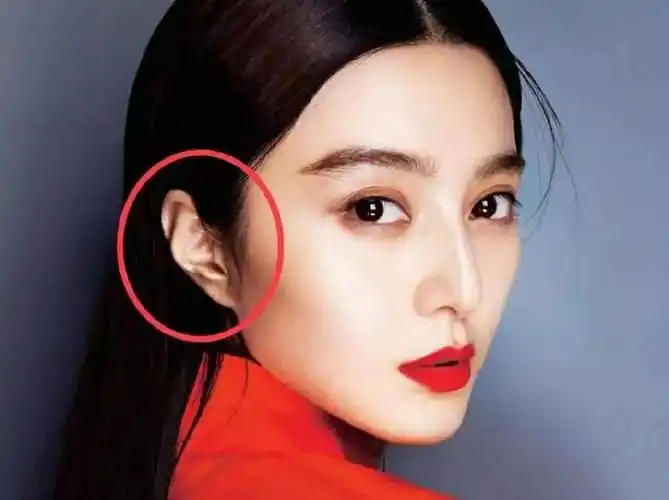 所谓的鼠耳,就是指耳朵偏小,耳型斜,无耳轮,无垂珠的类型.