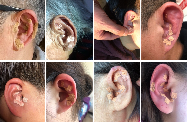 正知堂耳诊疗法