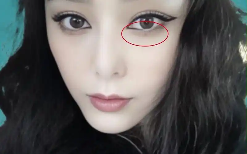 眼下有痣代表什么?