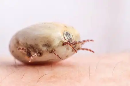 满腔热血坐在人体皮肤上的蜱虫照片