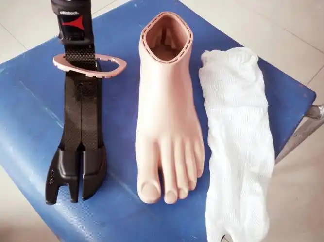 小腿标价3万5的假肢多少钱就能买了