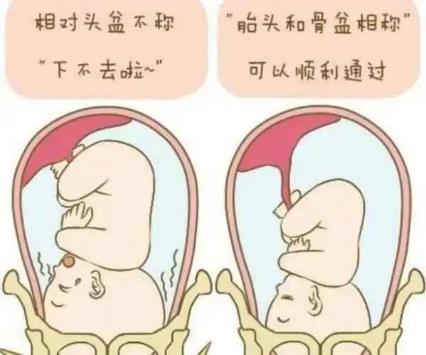 胎儿未入盆是否会影响顺产呢孕妈需了解