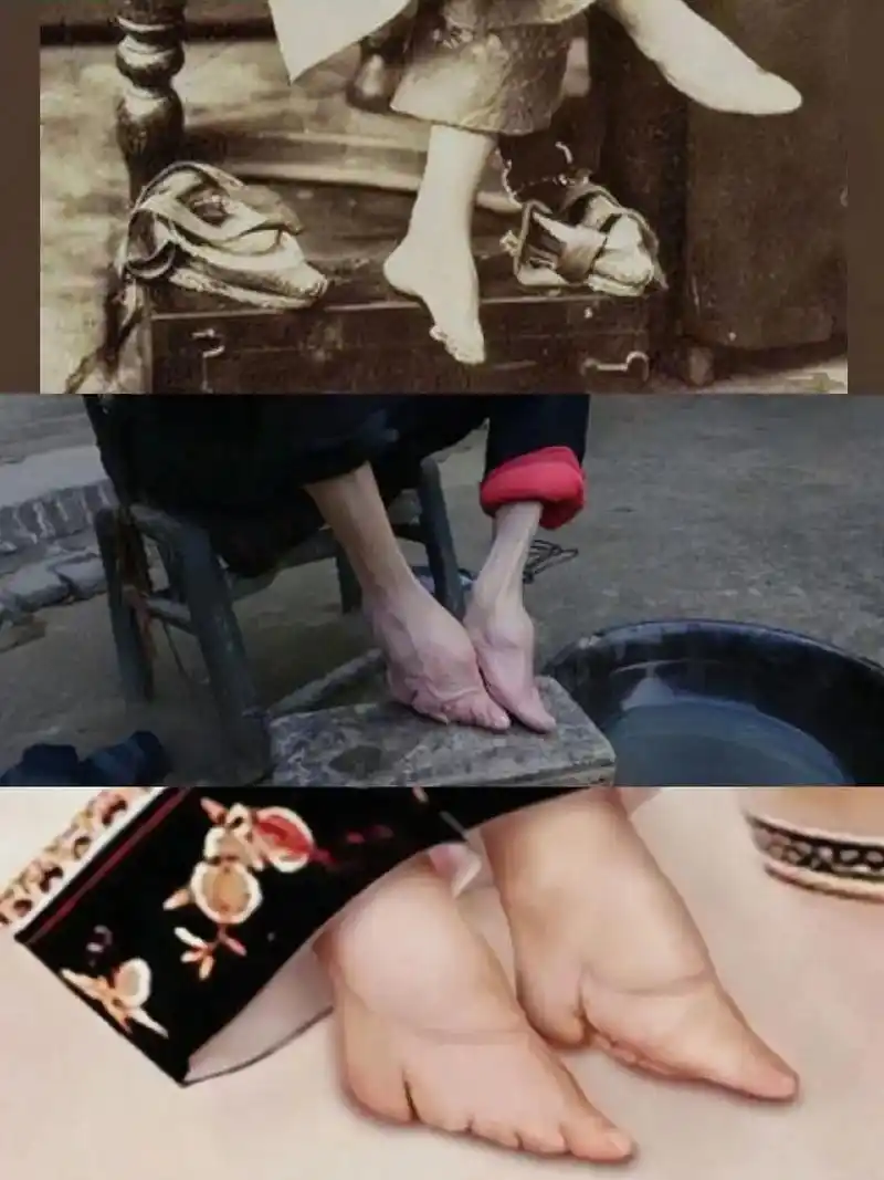 缠小脚这一封建社会的恶俗千百年来残害了数不清的中国妇女.