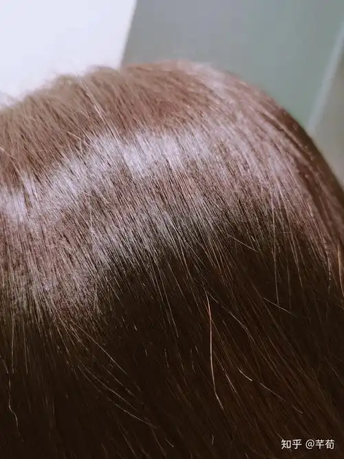 白头发拔一根长十根,真的吗?