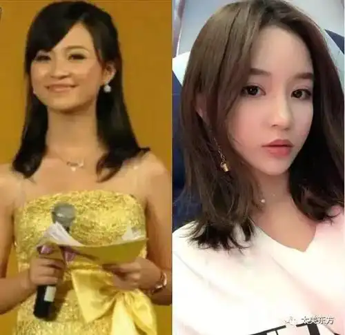 黄诗棋的粉丝量也是不容小觑~可是若粉丝看到整容前的照片会脱粉吧