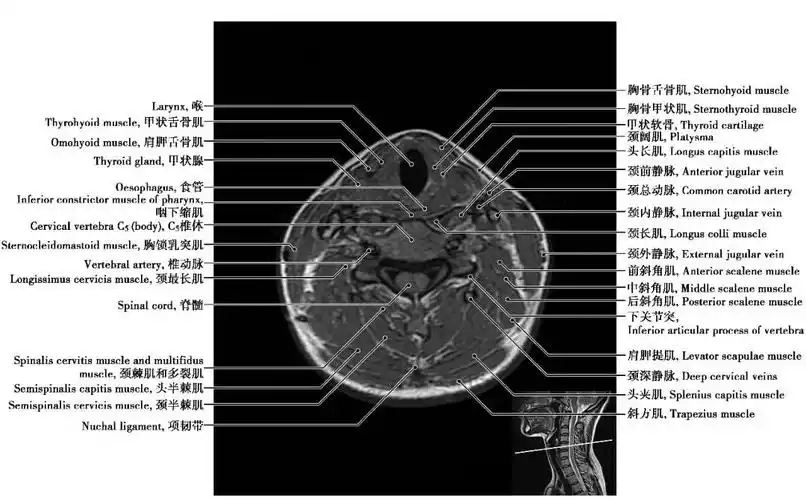 中枢神经系统影像解剖图谱连载2颈椎mri概论t1wi轴位解剖图