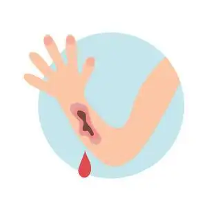 鲜血救人图片-鲜血救人素材-鲜血救人插画-摄图新视界