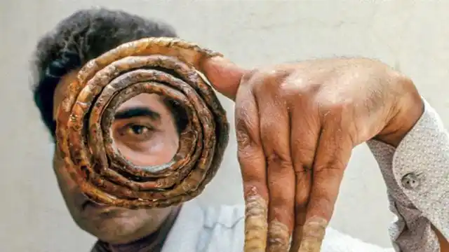 世界上最长的指甲,总长9.09米,网友:像枯树枝!