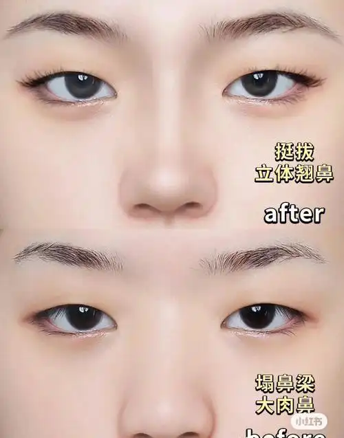 好看的鼻子这么修出来