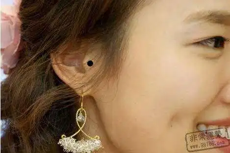 女人10处有痣是富贵痣:身上最有福气的10处痣(图)