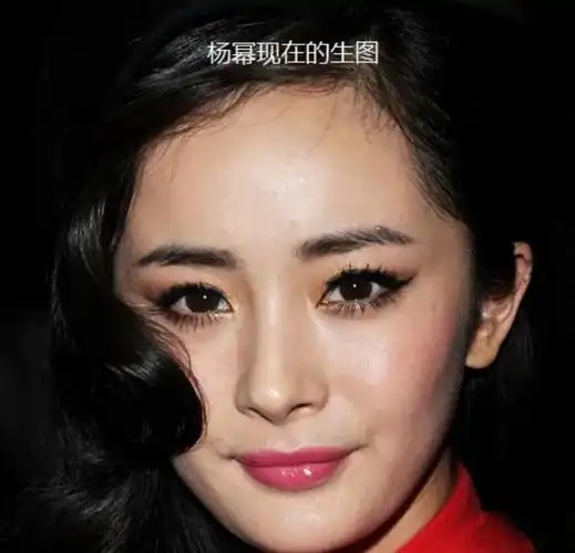 自体脂肪填充面部靠谱吗自体脂肪填充全脸能达到很自然的程度吗