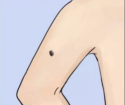 痣相看命运:手臂这处有痣的人,命中财运好,富贵双全家业旺