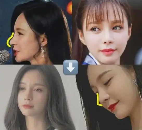 网上冲浪的宝宝应该都知道沈梦辰的鼻子也是经过迭代的,中间也出现过"