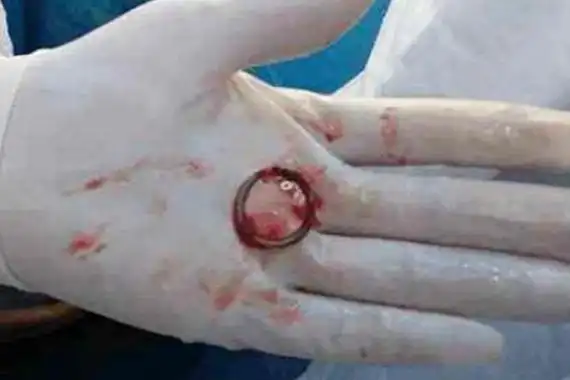 三四十年后,首批"上环"的女性过得如何?妈妈们的现状令人唏嘘