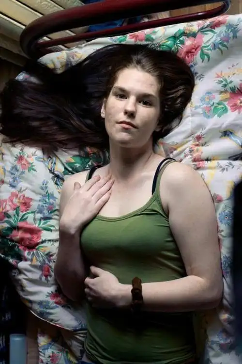 一个加拿大漂亮女孩吸毒恐怖过程,牙齿变黑,满脸黑斑