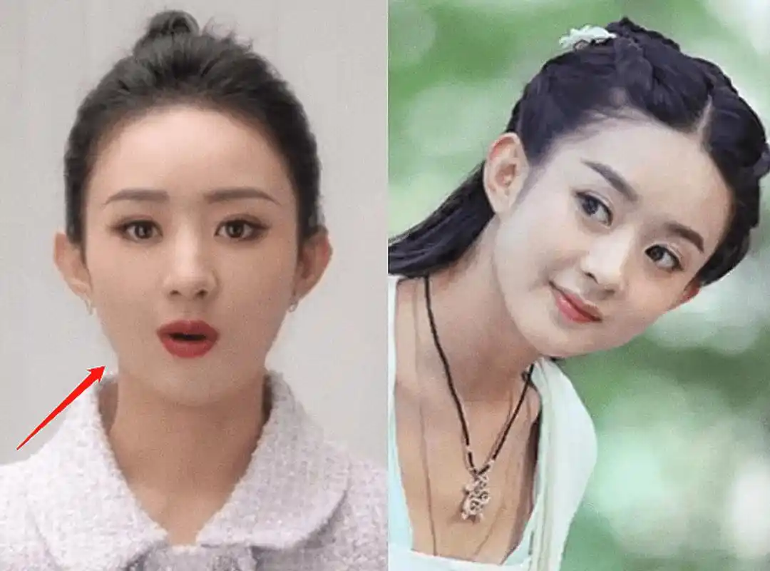 不过,当镜头拉近后,就能明显看到赵丽颖的容貌发生了很大的变化,堪称