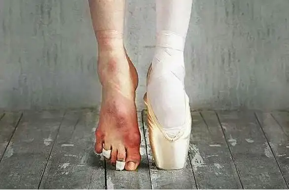 芭蕾舞脚(芭蕾舞脚尖)-生活常识-江湖救急网