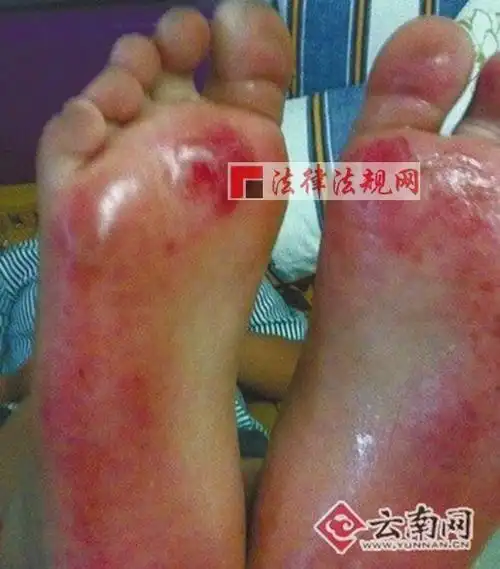 高温被罚光脚跑步 [哈哈镜]