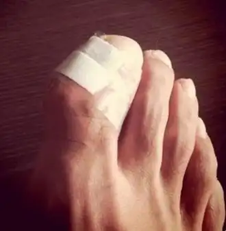 余文乐脚生毒疮入院治疗 易建联微博慰问(图)