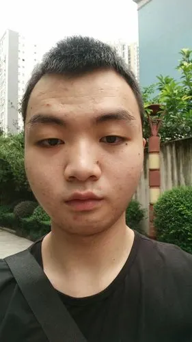 是不是跟我只用一步咀嚼有关系.但是我是左边咀嚼,怎么右边跟大呢?