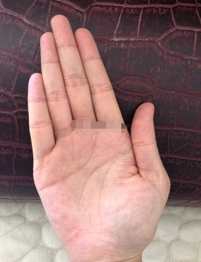 手相中有岛纹感情路不顺利会有阻碍难遇正缘