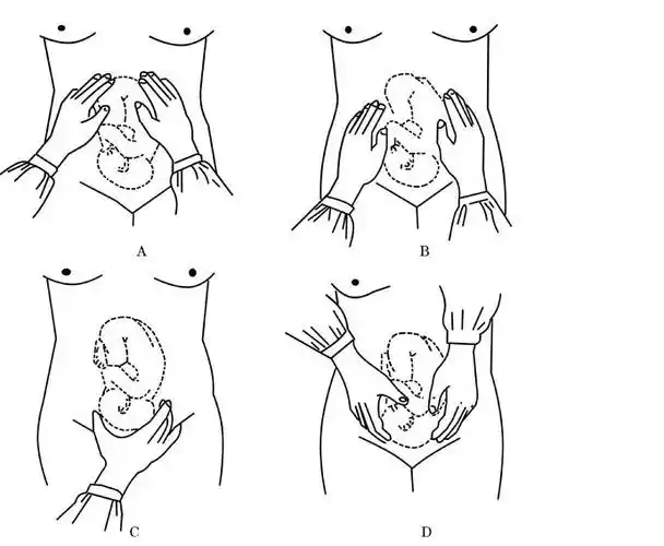 产检的时候医生摸肚子是在摸什么