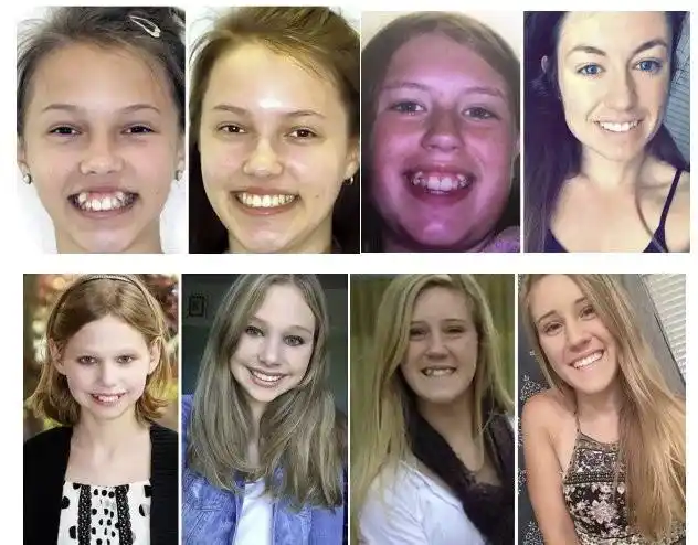 你的"虎牙"好看吗?