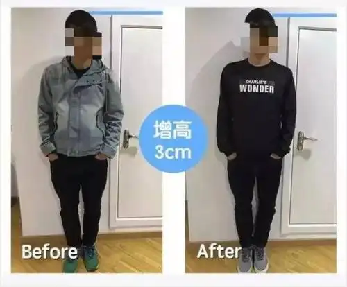 25岁时长高5公分,并帮助无数学员实现增高,他说普通人也能实现快速