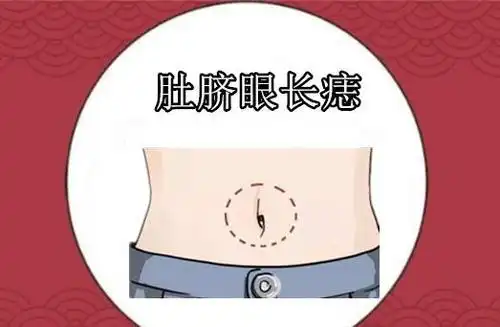 腹部有痣代表什么主要看肚脐周围的痣女人肚脐眼正下方有痣