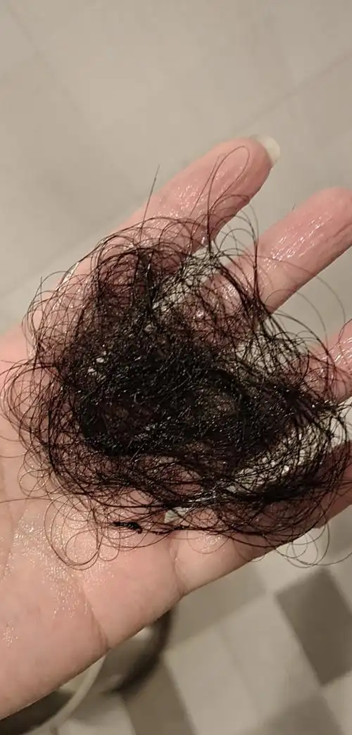 这才是脱发的量