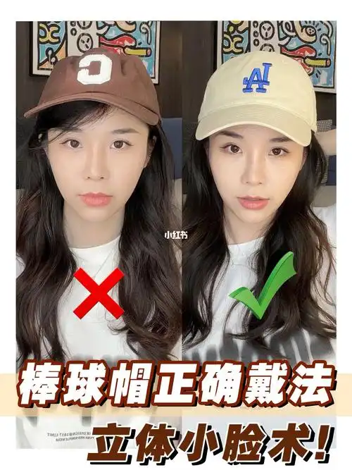 怎么戴棒球帽显脸小71高颅顶头包脸75