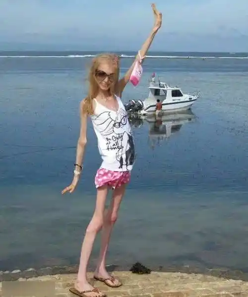 曲纤美担担瘦减肥效果怎么样,是 谁有办法减肥啊