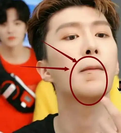 范丞丞直播被截图,粉丝被他的下巴吸引,放大画面让人很心疼