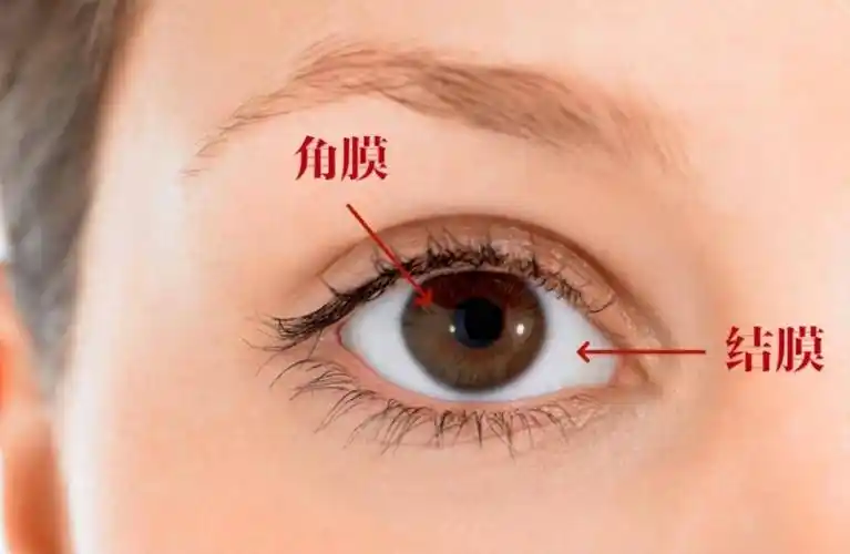 结膜炎则发生于结膜,即覆盖于上,下眼睑内面和"眼白"上的半透明的黏膜