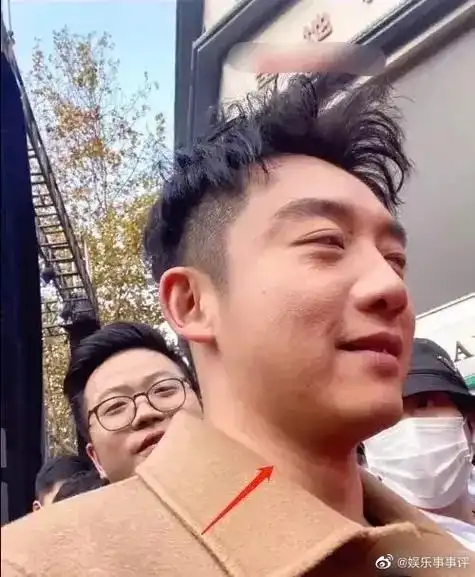 郑恺高清照皮肤差成油腻大叔