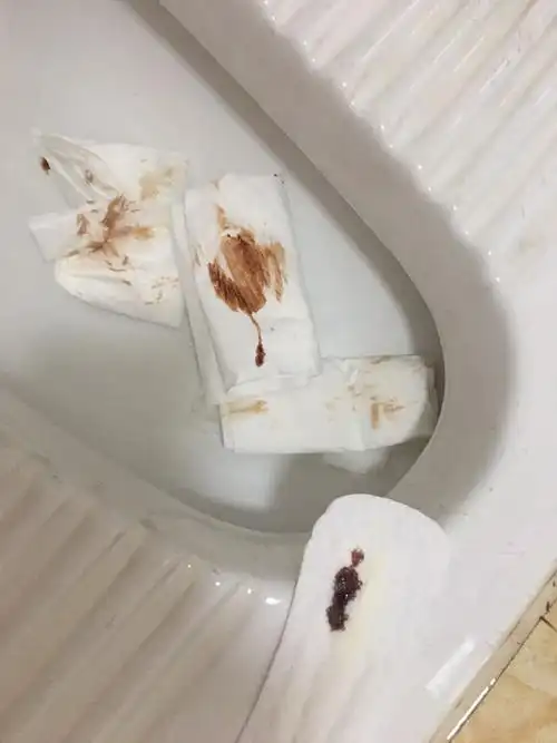 [试管婴儿]怀孕8周 ,今天流了好多褐色的