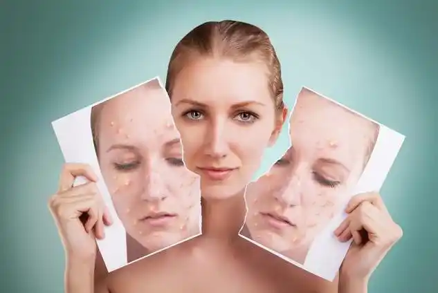 脸上的皮肤修复_她时代-女性时尚生活宝典